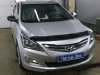 Hyundai Solaris ustanovka golovnogo ustroistva